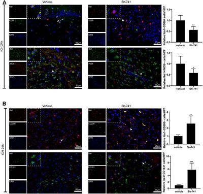 LncRNA TCONS_00145741 Knockdown Prevents Thrombin-Induced M1 Differentiation of Microglia in Intracerebral Hemorrhage by Enhancing the Interaction Between DUSP6 and JNK